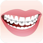 Orthodontic